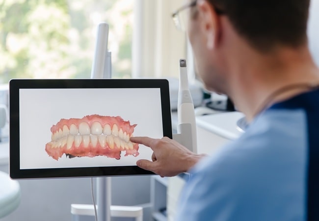 intraoral-camera-ambrosi-place-dental-care